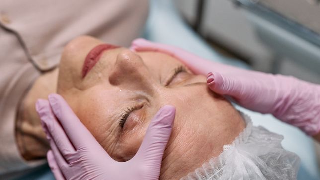 Microneedling for Hyperpigmentation